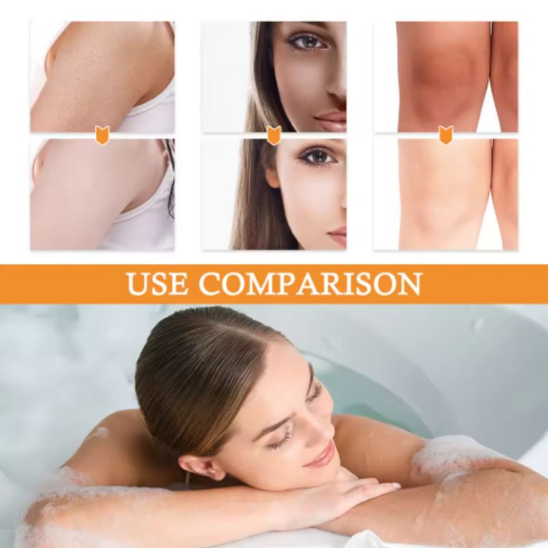 Turmeric Kojic Acid Dark Spot Remover Soap Bars
