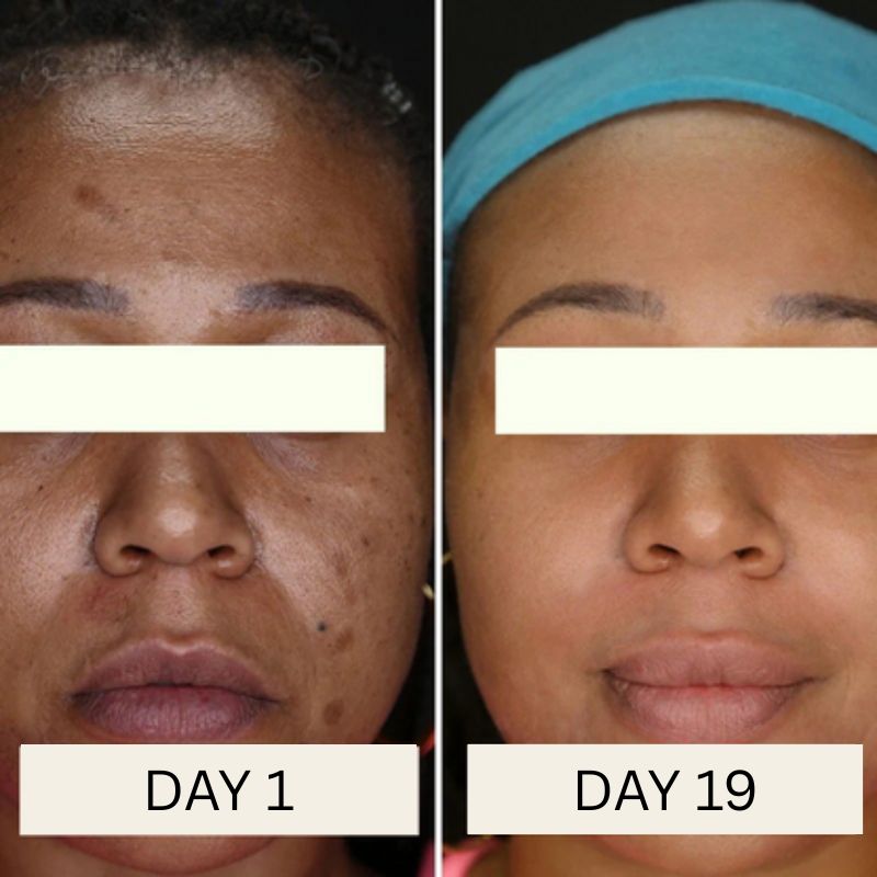 Korean Toner Pads for Wrinkles, Dark Spots & Radiant Glow