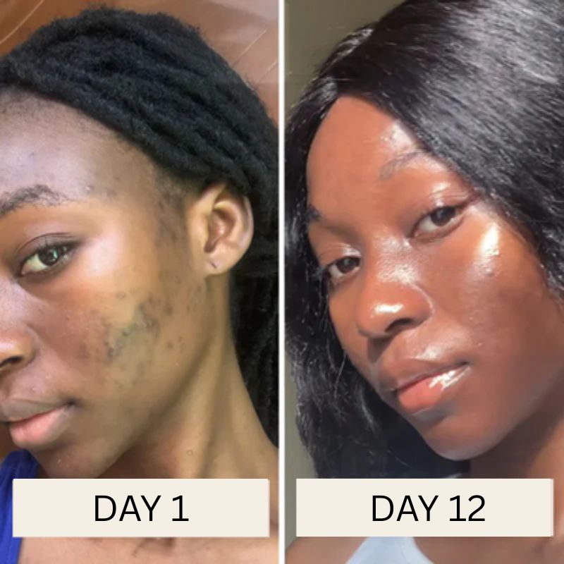 Korean Toner Pads for Wrinkles, Dark Spots & Radiant Glow