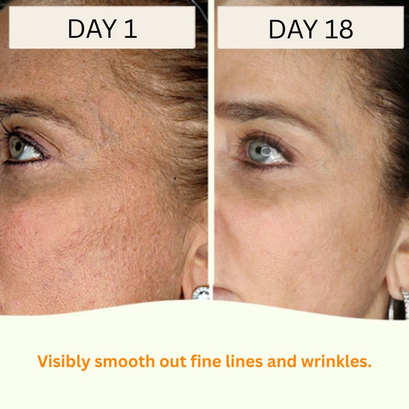 Korean Toner Pads for Wrinkles, Dark Spots & Radiant Glow