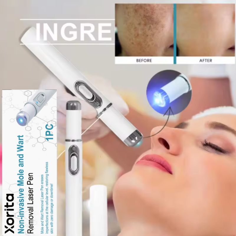 Mole and Wart Removal Laser Pen
