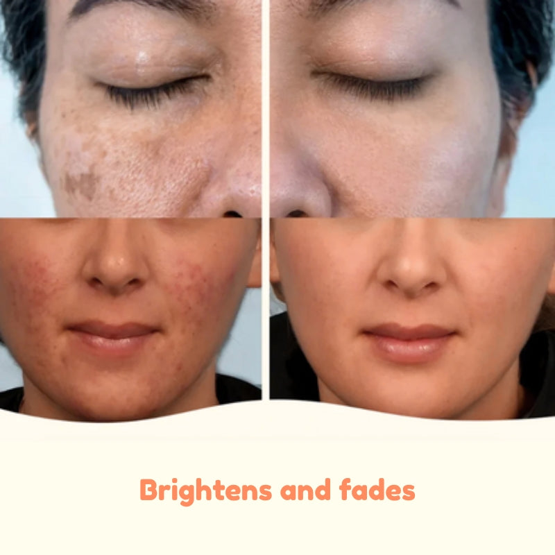 Korean Toner Pads for Wrinkles, Dark Spots & Radiant Glow