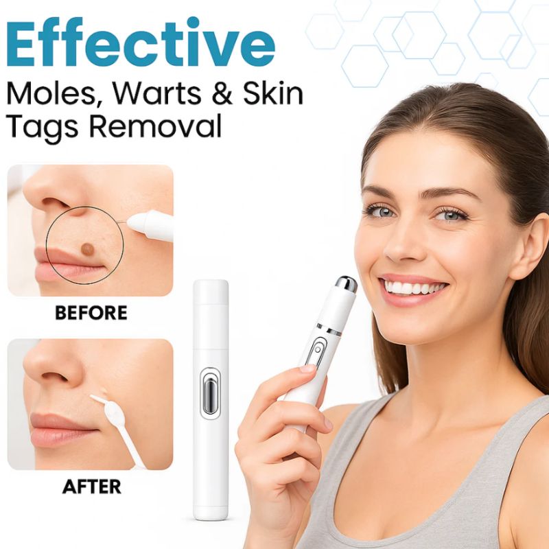 Mole and Wart Removal Laser Pen