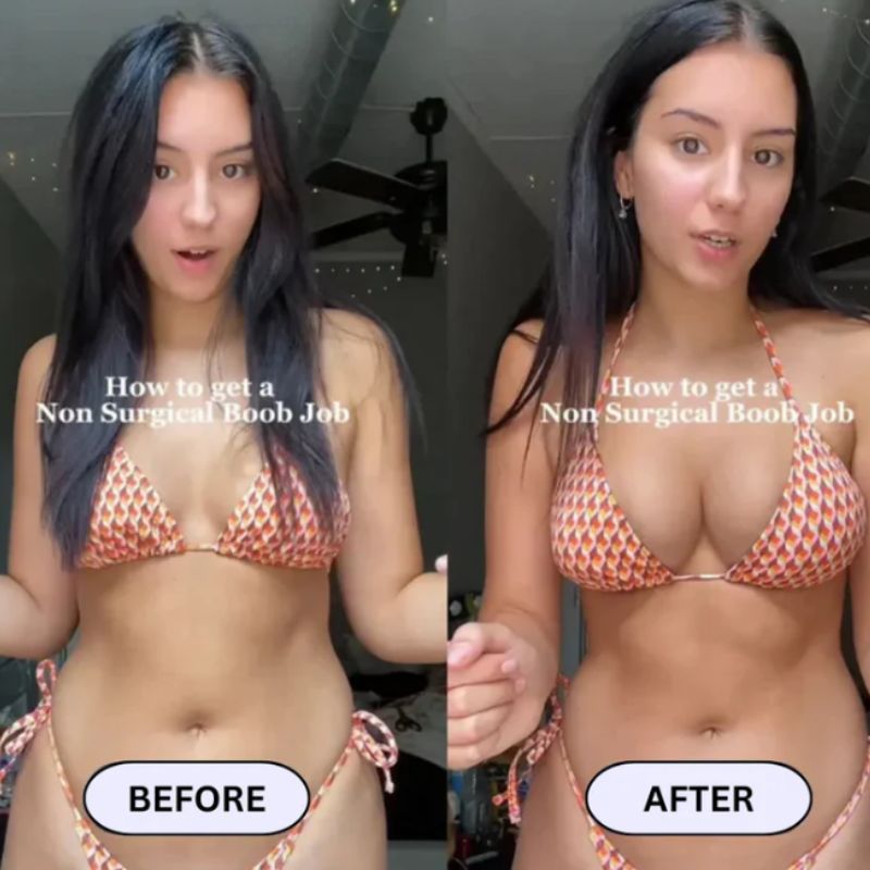 Sticky Inserts Instant Boost Non-Adhesive Nip Covers