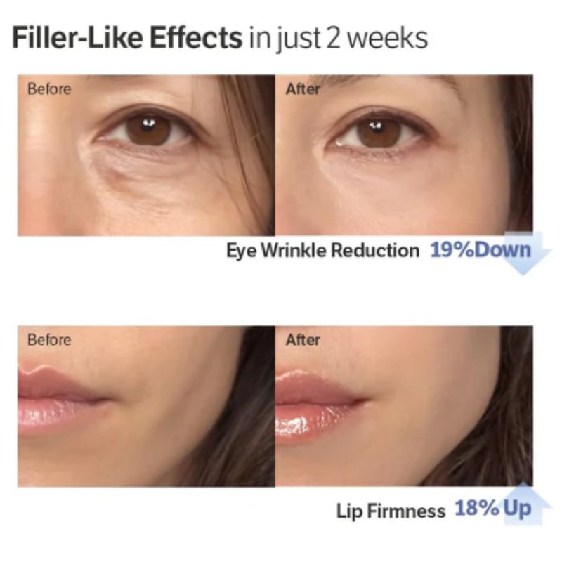 DermaLift™ Volufiline-Boosted Korean Collagen Serum