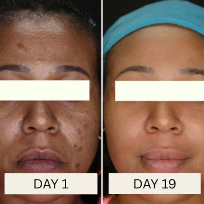 Korean Toner Pads for Wrinkles, Dark Spots & Radiant Glow