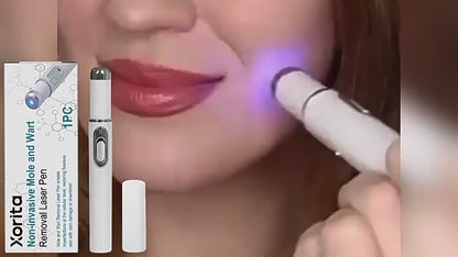 Mole and Wart Removal Laser Pen